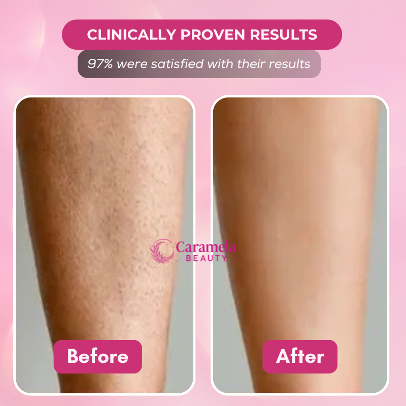 Caramela Beauty™ Cyperus Rotundus Oil for Natural Permanent Hair Reduction